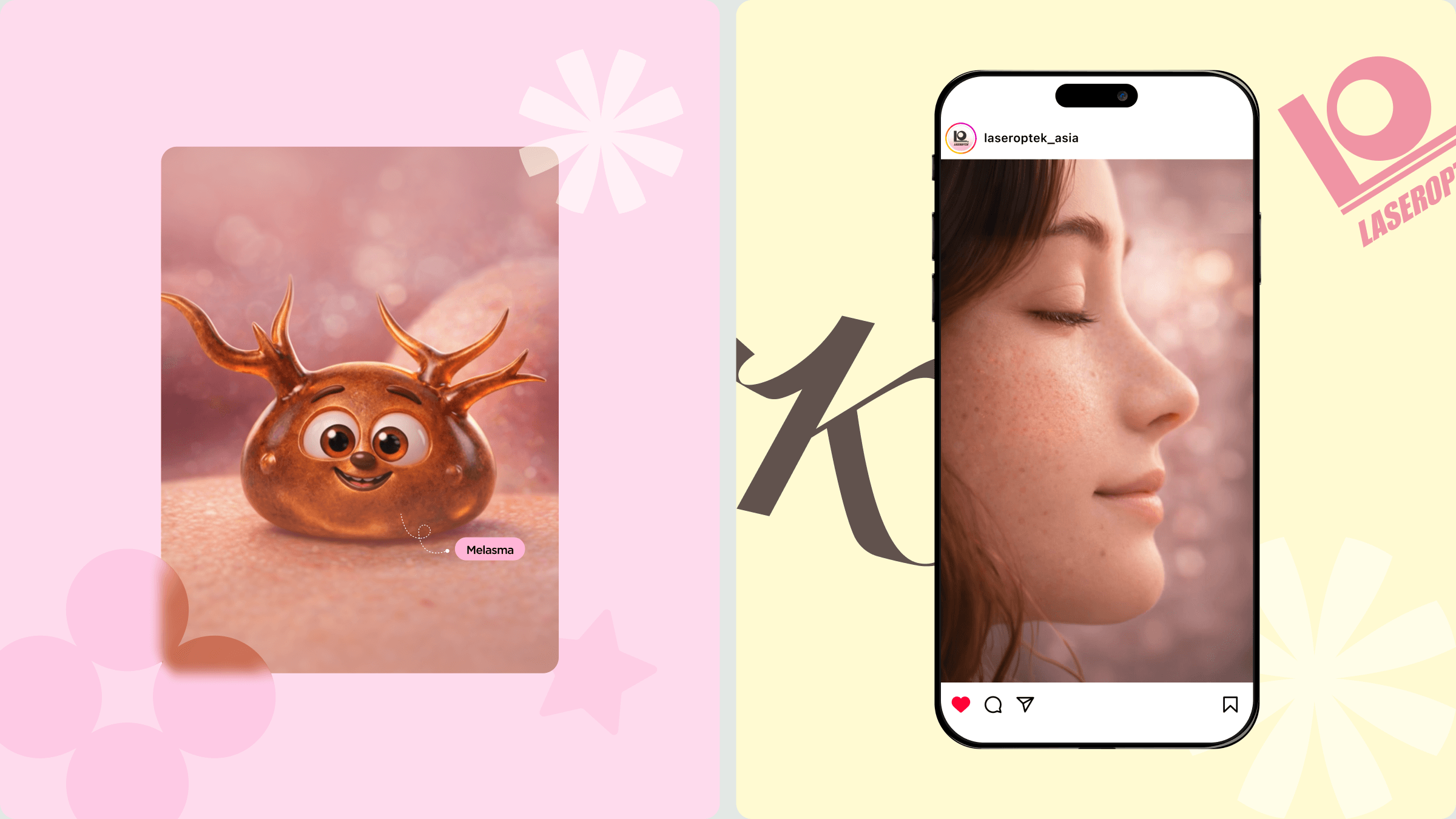 레이저옵텍 — Asia l 기술을 피부 고민의 언어로